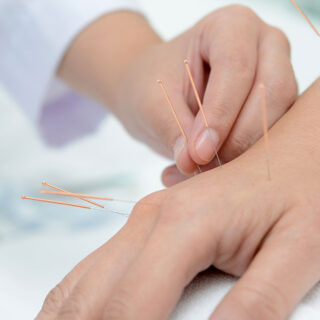 acupuncture-ft