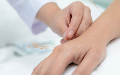 acupuncture-ft